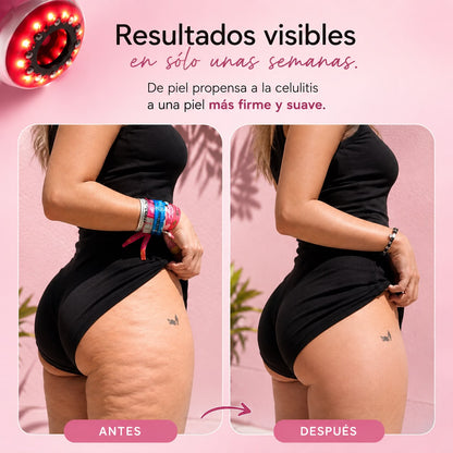 Ed Limitada"Ventosa Profesional®" La técnica profesional de spa, ahora en casa
