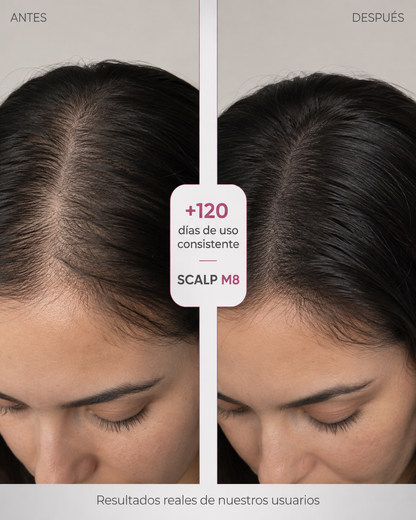 Masajeador de Cuero Cabelludo Premium® Alivio Inmediato + Cabello más Fuerte